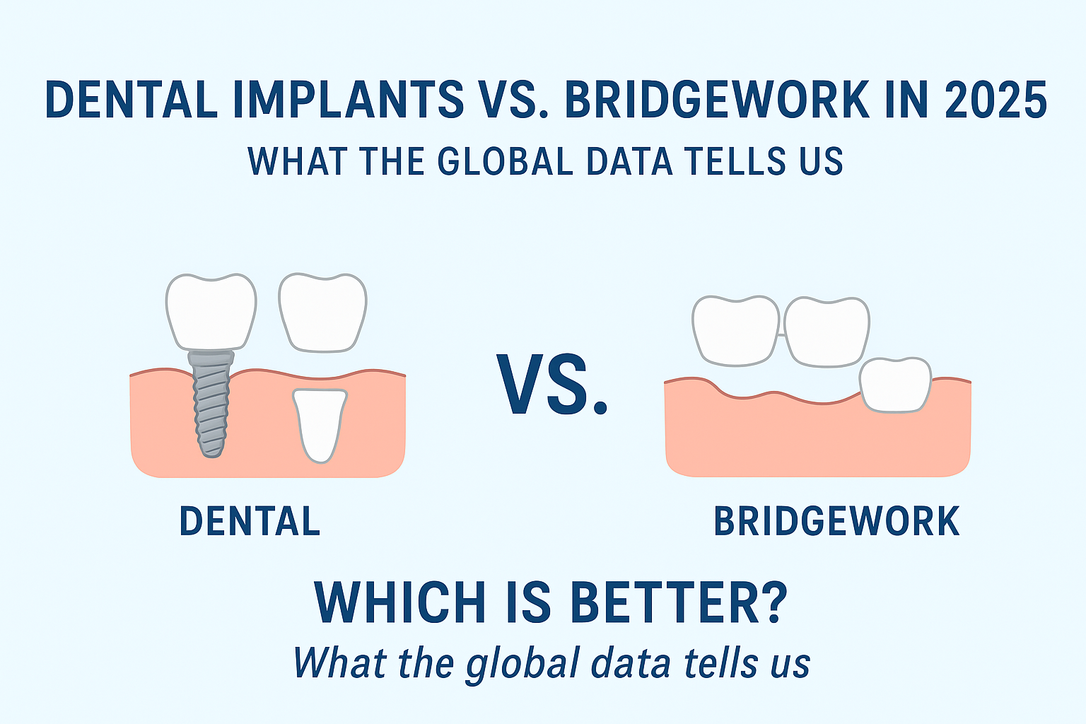 ? Dental Implants vs. Bridgework in 2025: What the Global Data Tells Us